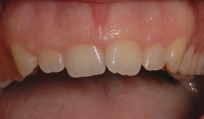 estetica_dental