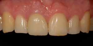 estetica_dental