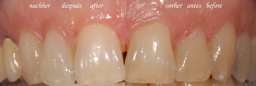 estetica_dental