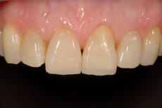 estetica_dental