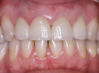 estetica_dental