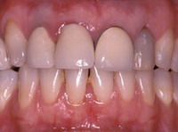 estetica_dental