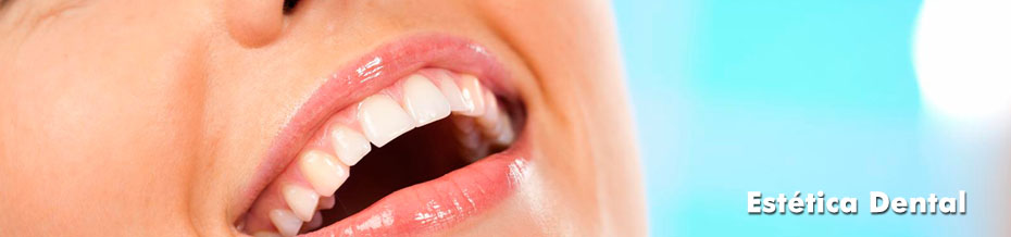 estetica_dental