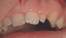 estetica_dental